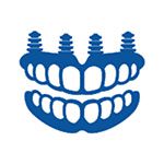 All on 4 Dental Implants
